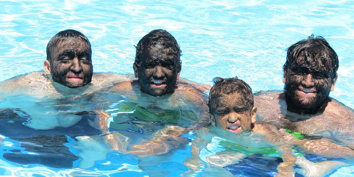 A family in Mexico covers 98% of their body hair